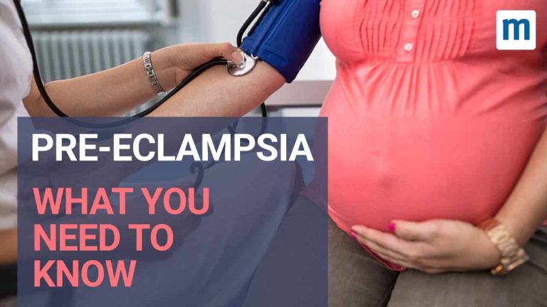 Prééclampsie : diagnostic et prise en charge d&rsquo;une urgence chez la femme enceinte