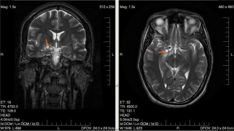 Ce bébé a vaincu le cancer à seulement 4 mois de vie